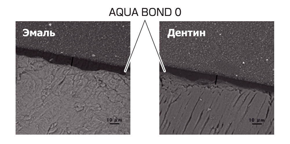 Ямакинаквабонд4